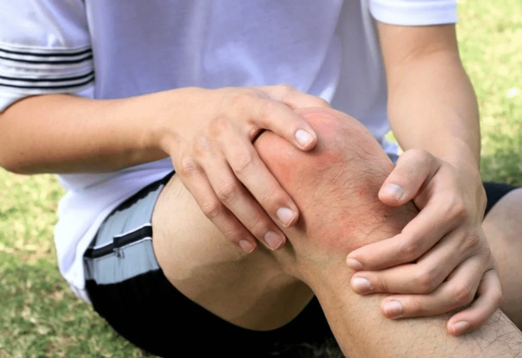 Гонартроз колінного суглоба: симптоми, причини, діагностика та лікування