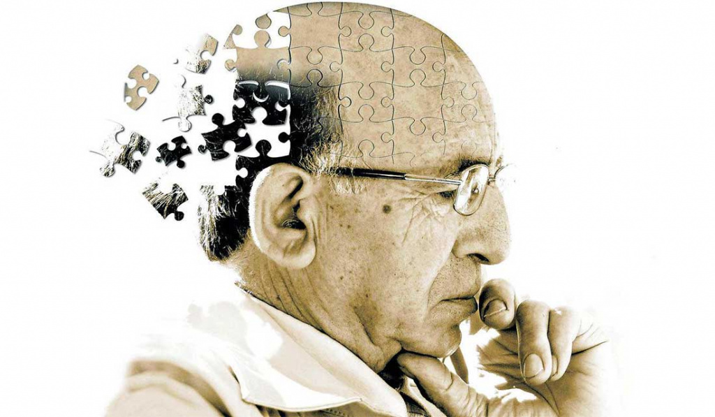 Хвороба Альцгеймера ✔: симптоми, ознаки та причини, діагностика та лікування