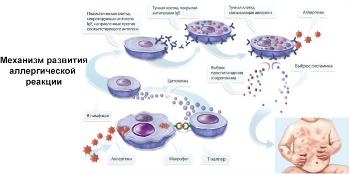 Алергічний дерматит у дітей - різновиди, симптоми та як лікувати