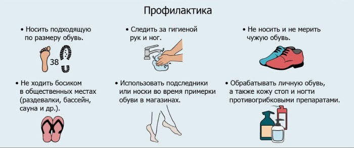 Лікування грибка нігтів у домашніх умовах препаратами та народними методами