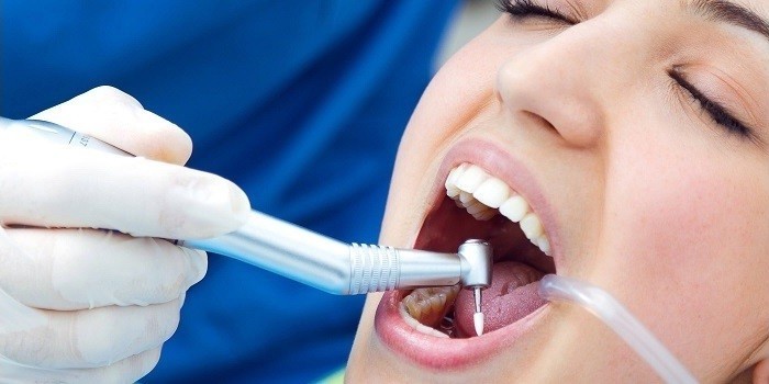 Чому болить зуб після пломбування каналів