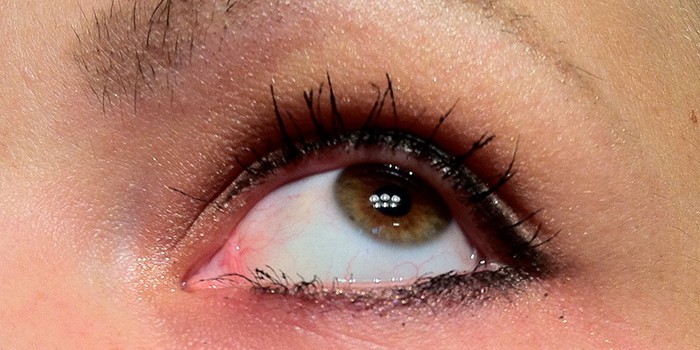 Причини сверблячки в очах - алергія, хронічна втома, недосипання