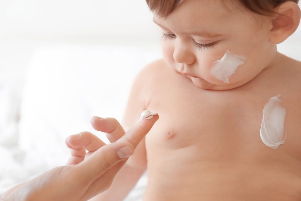 Суха шкіра у дітей: як доглядати
