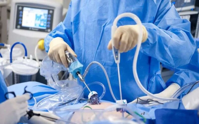 Гістероскопія