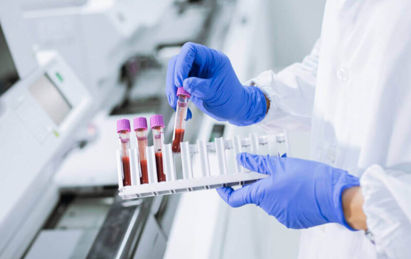 ПЛР-тест на ВІЛ