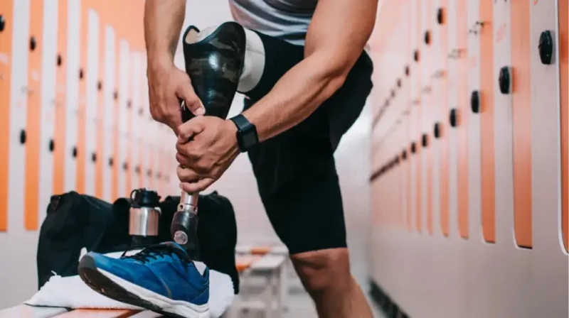 Біонічні протези стегна